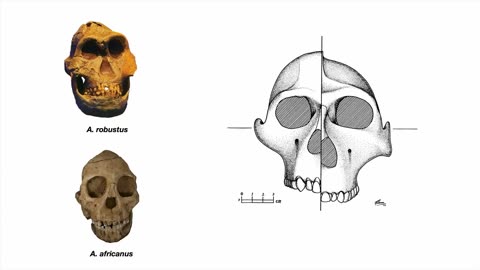 Paleopathology & the Origins of the Low Carb Diet