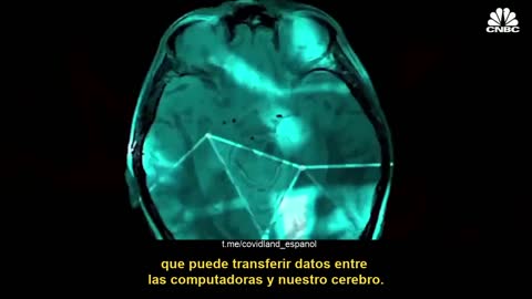 Neurolink: La fusion del hombre con la máquina.