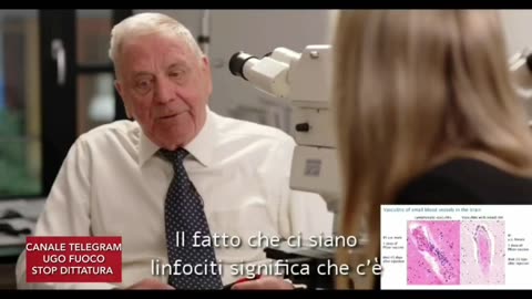 Dr. Burkhardt aveva scoperto che tutti i deceduti dopo vaccino presentavano la vasculite