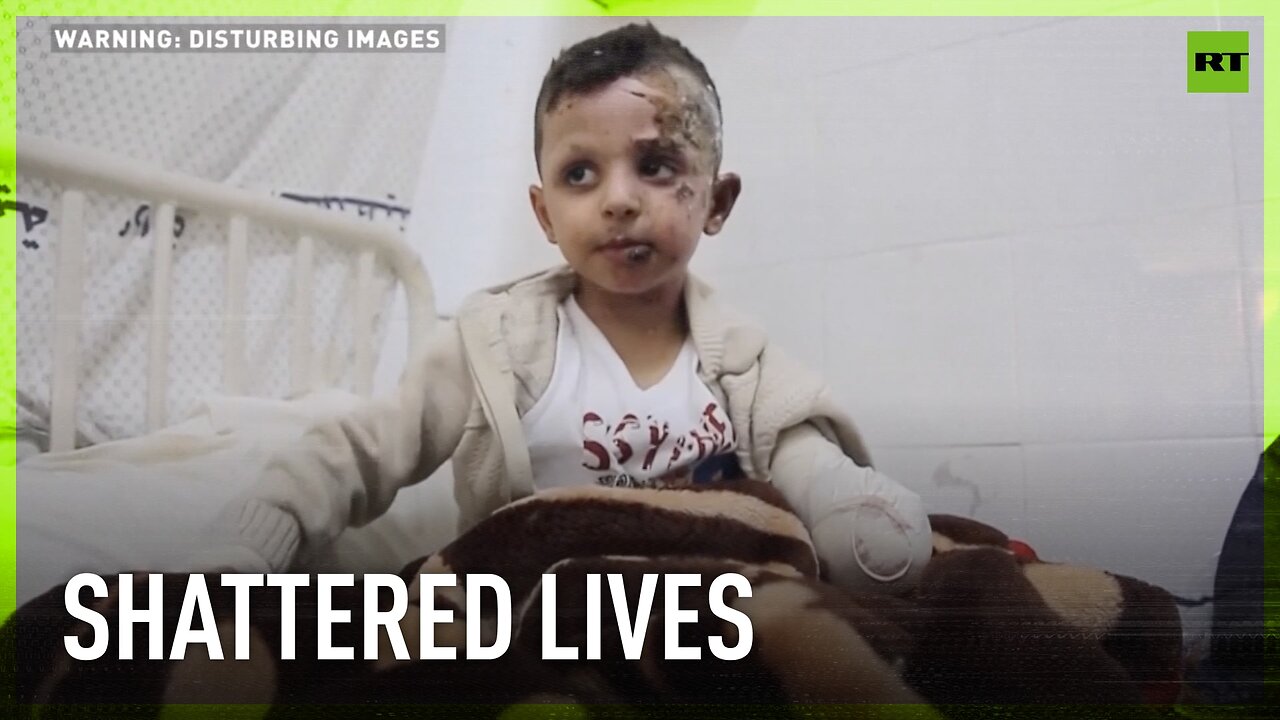 Heartbreaking | Gaza-Israel conflict leave hundreds of children with amputated limbs