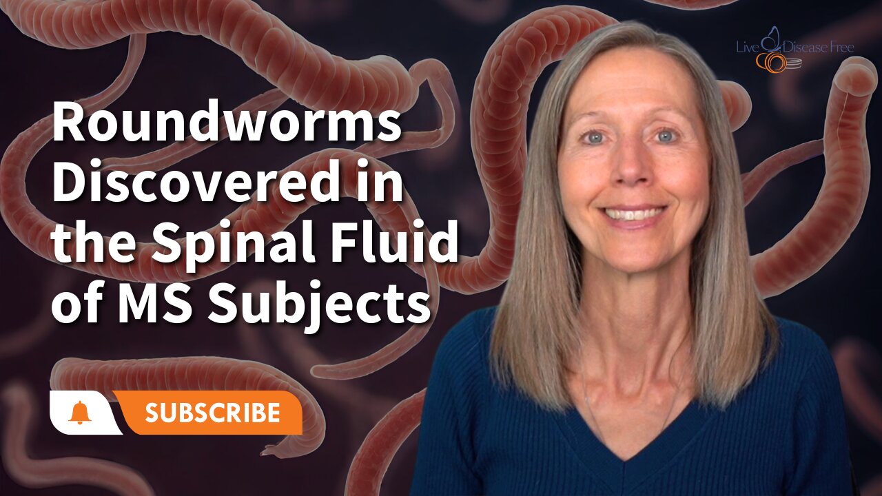 Roundworms Discovered in the Spinal Fluid of MS Subjects