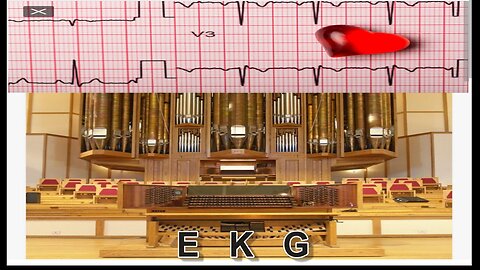 EKG