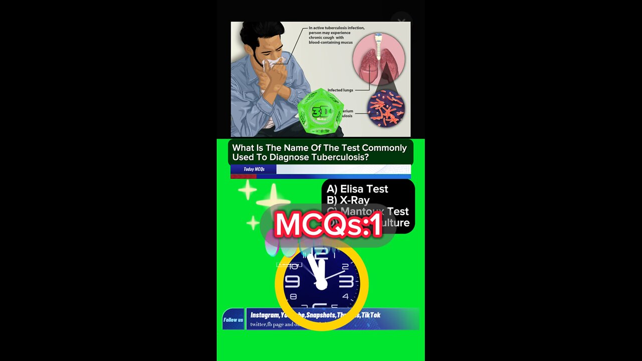 Tuberculosis mcqs #mcqs #students #medical