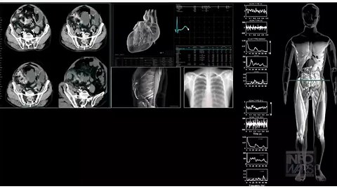 Ivermectin disrupts mitochondrial function in cancer cells leading to cell death