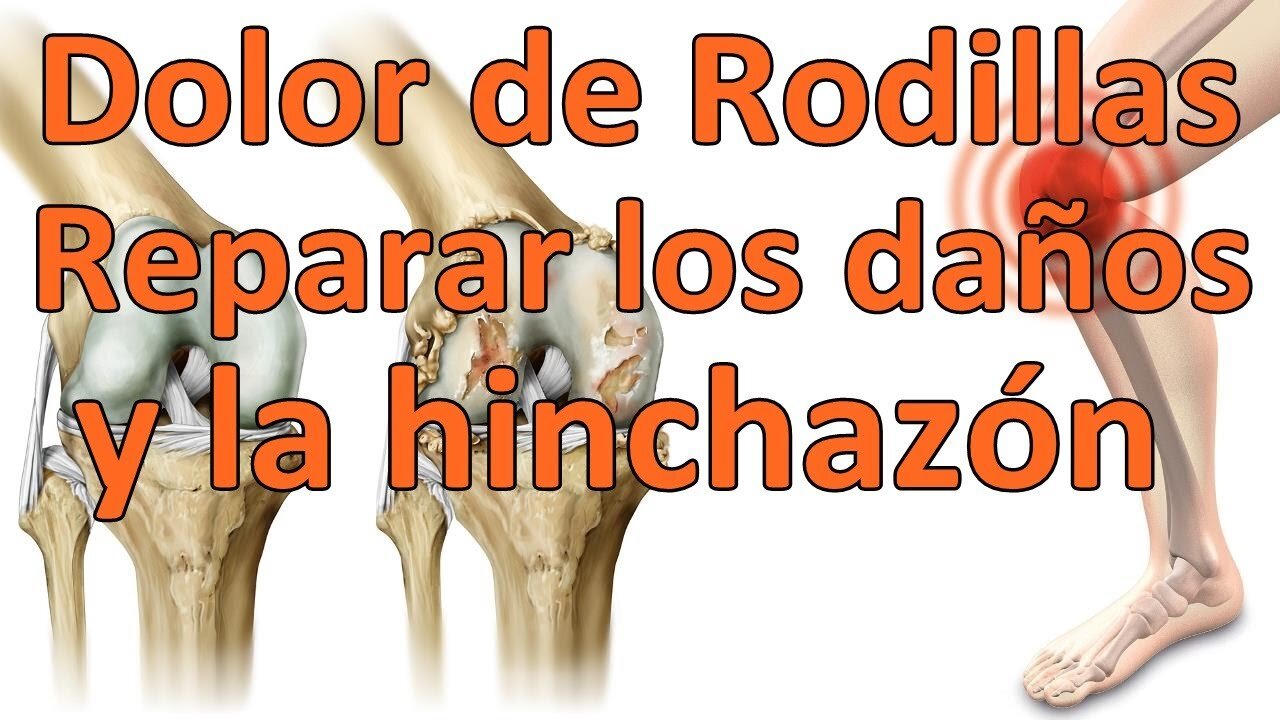 REGENERAR LOS PADECIMIENTOS EN LA RODILLA DE FORMA COMPLETA Y NATURAL Y ELIMINANDO EL DOLOR