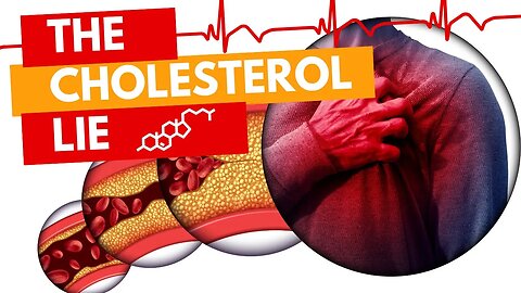 What You Need to Know About Cholesterol
