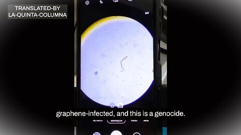 Shocking Dr Liliana Zelada Expert Showing Live Under Microscope Found in Covid Vaccine Vials