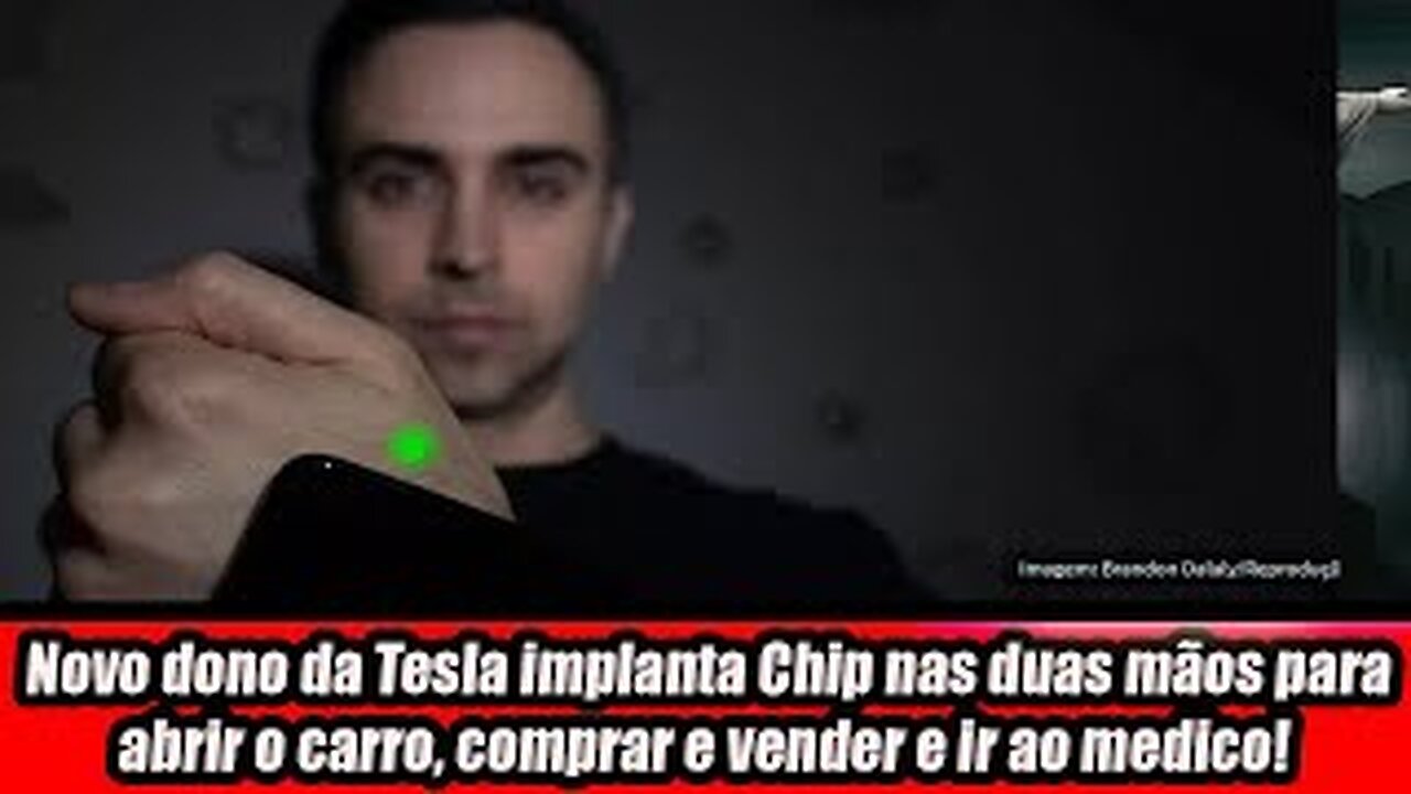 Novo dono da Tesla implanta Chip nas duas mãos para abrir o carro, comprar e vender e ir ao medico