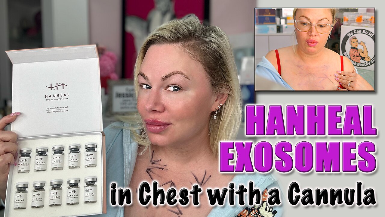 Hanheal Exosomes , Cannula Chest Meso Therapy, AceCosm | Code Jessica10 Saves you Money