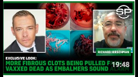 EXCLUSIVE LOOK: MORE Fibrous Clots Being Pulled From Vaxxed DEAD As Embalmers Sound Alarm