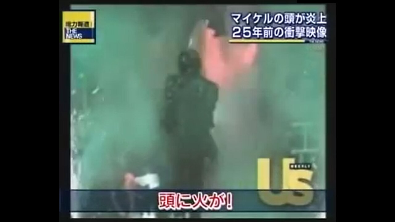 マイケル・ジャクソン ペプシコーラ撮影事故