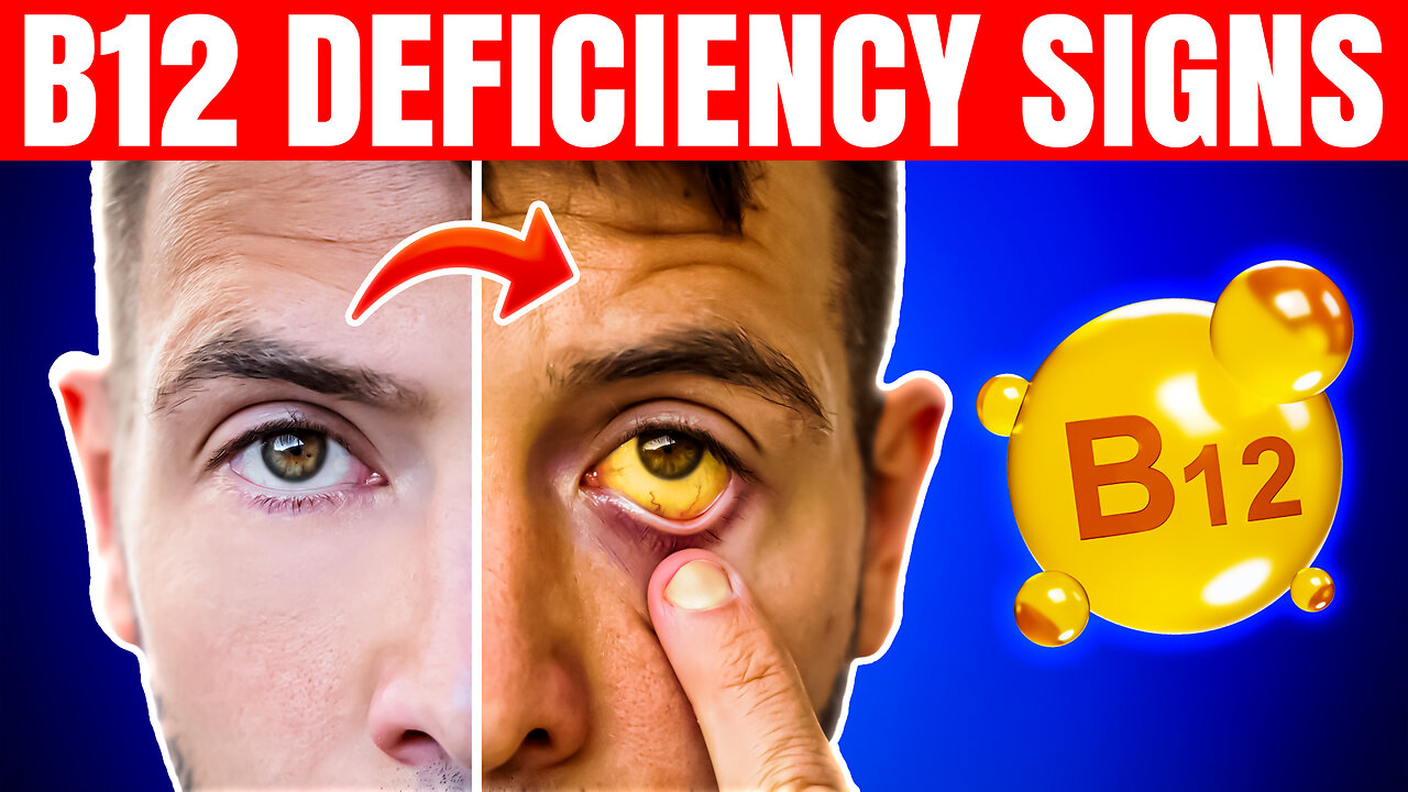 Warning Signs of Vitamin B12 Deficiency You Can’t Afford to Ignore!