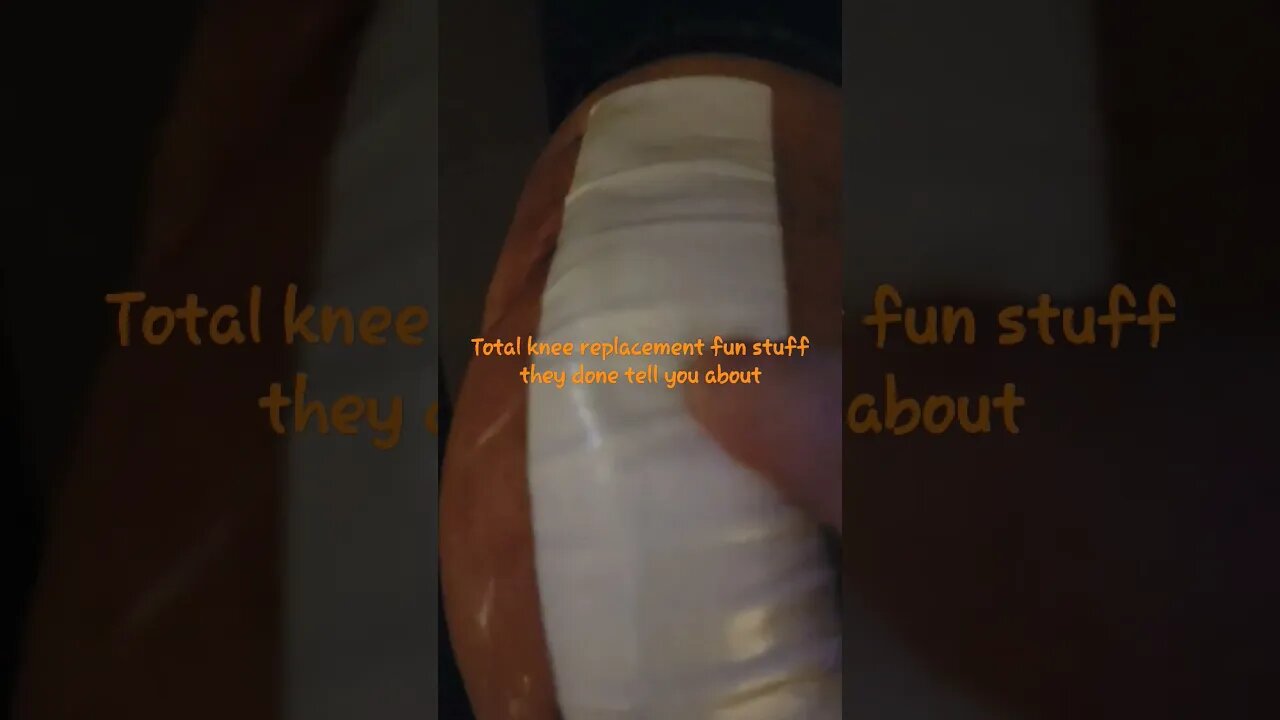 Fake kneecap meets fake knee