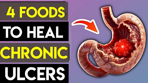 Your Chronic Stomach Ulcer Will Heal If You Eat These 4 Foods