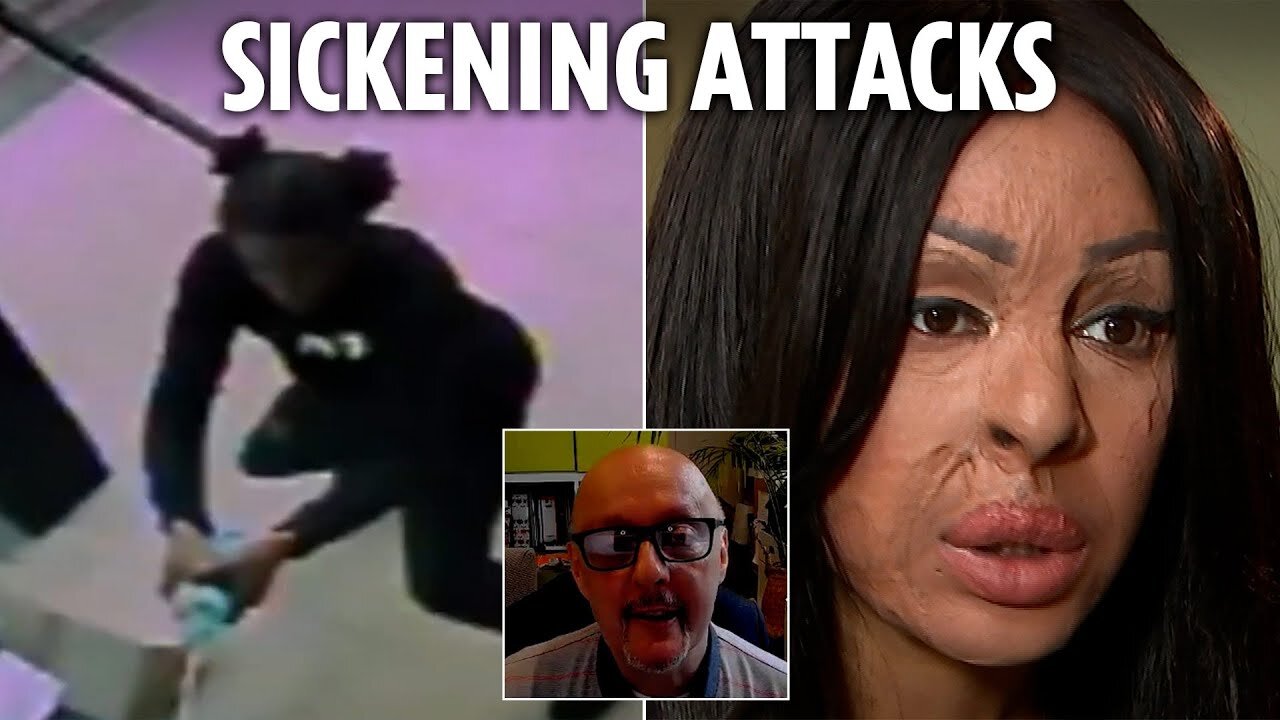 Melted eyeballs and mutilated faces...Inside terrifying acid attack ‘arms race’ sparking misery