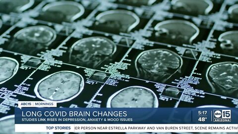 Studies link depression, anxiety and mood issues to those with long COVID
