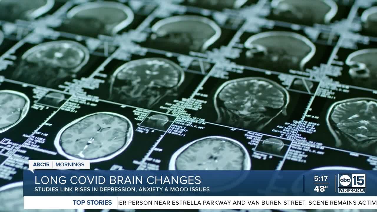 Studies link depression, anxiety and mood issues to those with long COVID