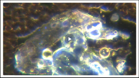 REESE REPORT -Self-Replicating Nanobots Found in both the Vaxxed and UnVaxxed