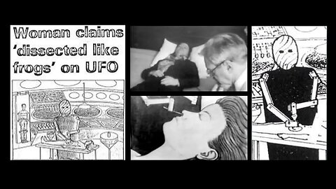 “Woman claims ‘dissected like frogs’ on UFO” - Sandy Larson’s alien abduction experience, 1975