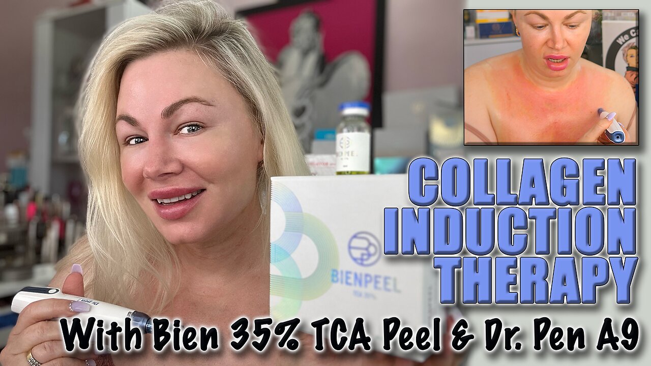 Collagen Induction Therapy with Dr.Pen A9 and Bein 35% TCA Peel! Code Jessica10 saves you Money