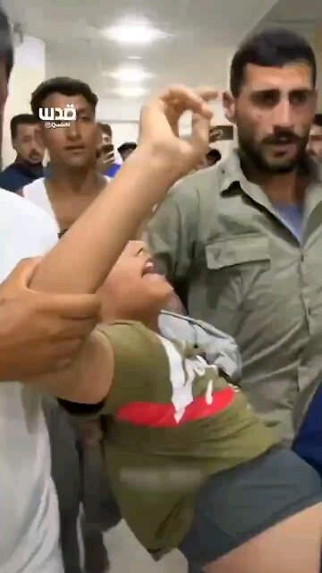 Another poor "Palestinian" kid shot in the back by Israelis! But where's the blood? Screams of pain?