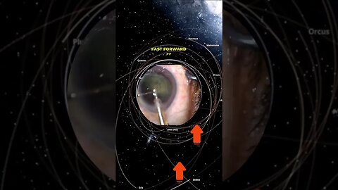 eye surgery - scroll rott #nonsense #zoobox #reddit #eyes #cataracts