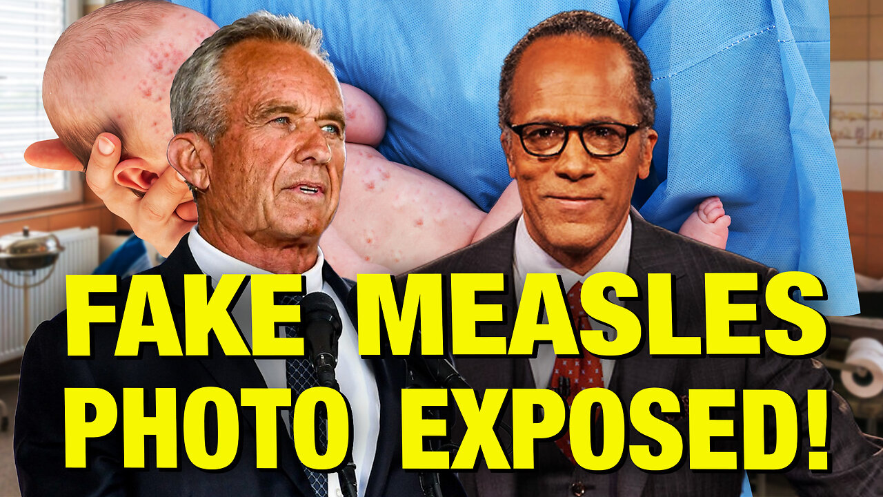 NBC Doctored Up This Photo Of A Baby With Measles!