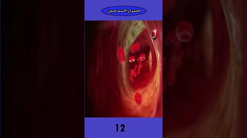 أضرار التدخين معلومات مفاجئة - The harms of smoking surprising information (English Subtitle)