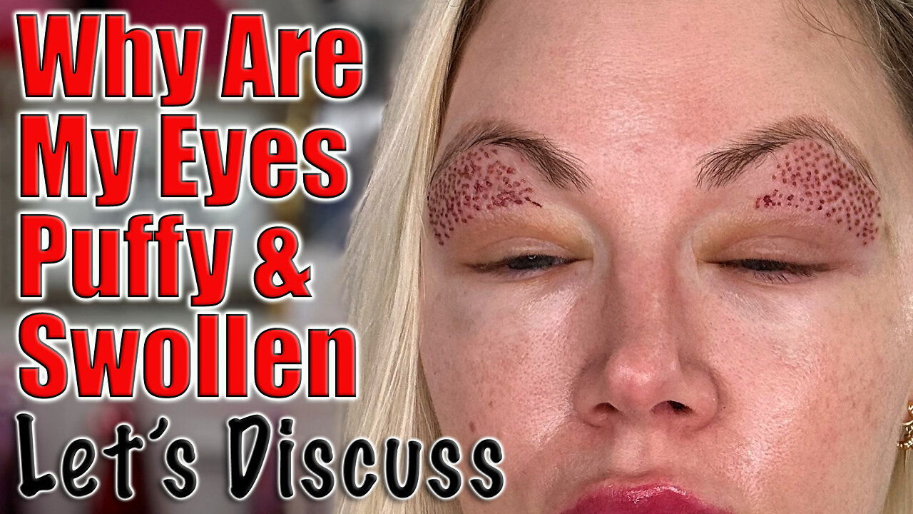 Why Are my Eyes Swollen and Puffy? Let's Discuss | Code Jessica10 saves you Money at Approved Vendor