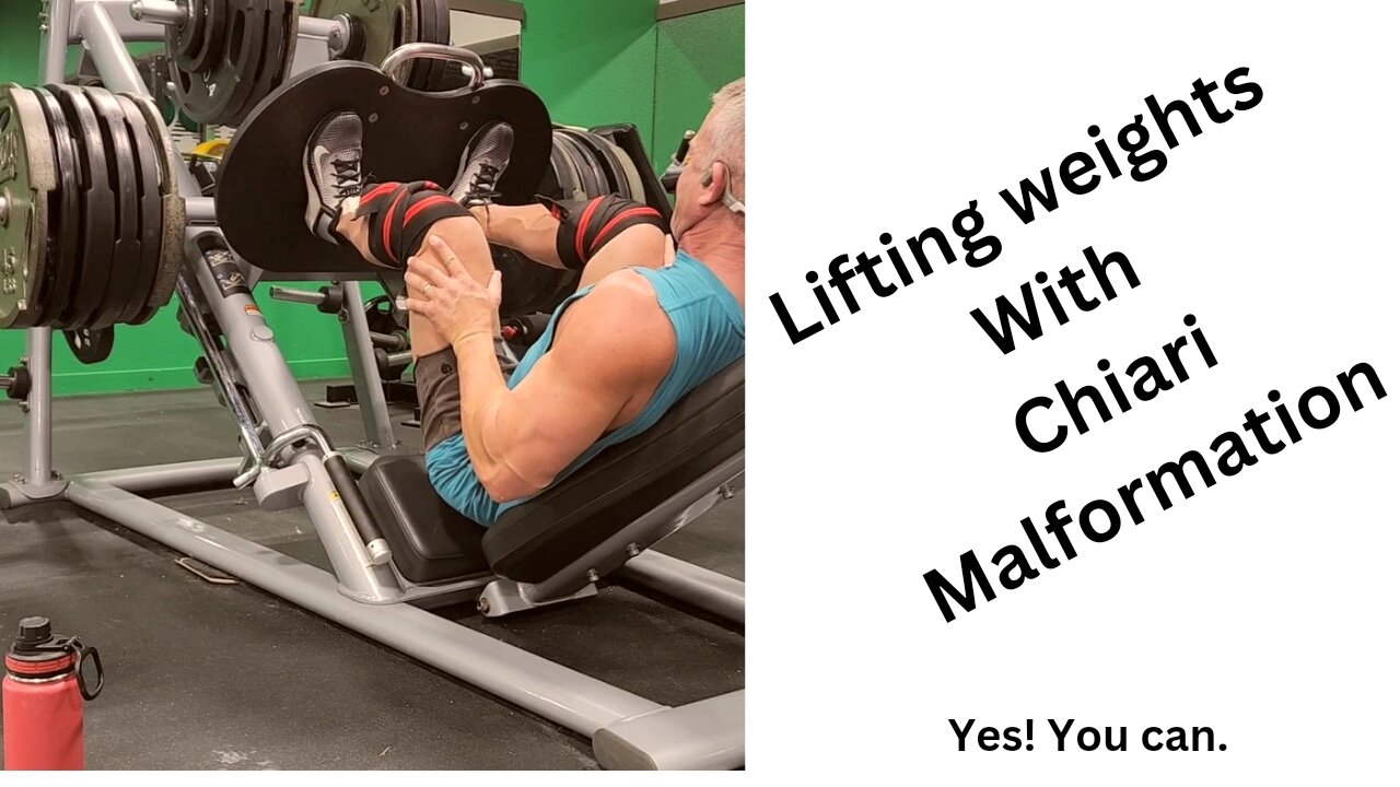 Lifting weights with Chairi Malformation