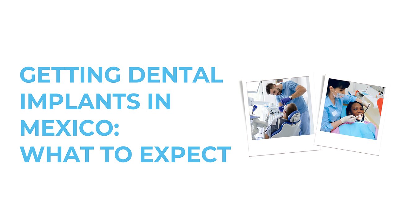 Getting Dental Implants in Mexico: What to Expect