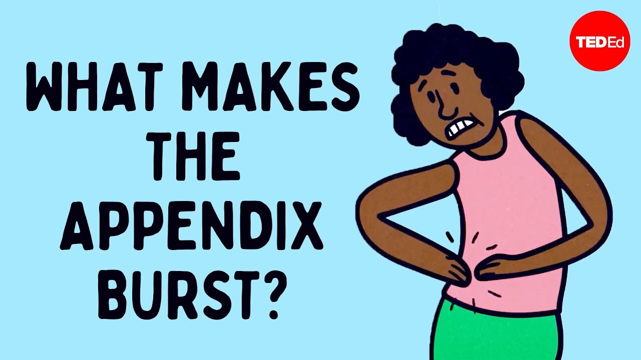 What does appendix pain feel like? - David R. Flum