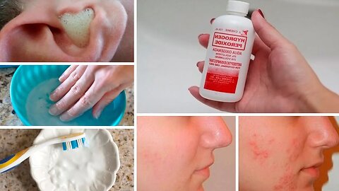 5 USOS del AGUA OXIGENADA que Cambiarán tu Vida 🥛 💚