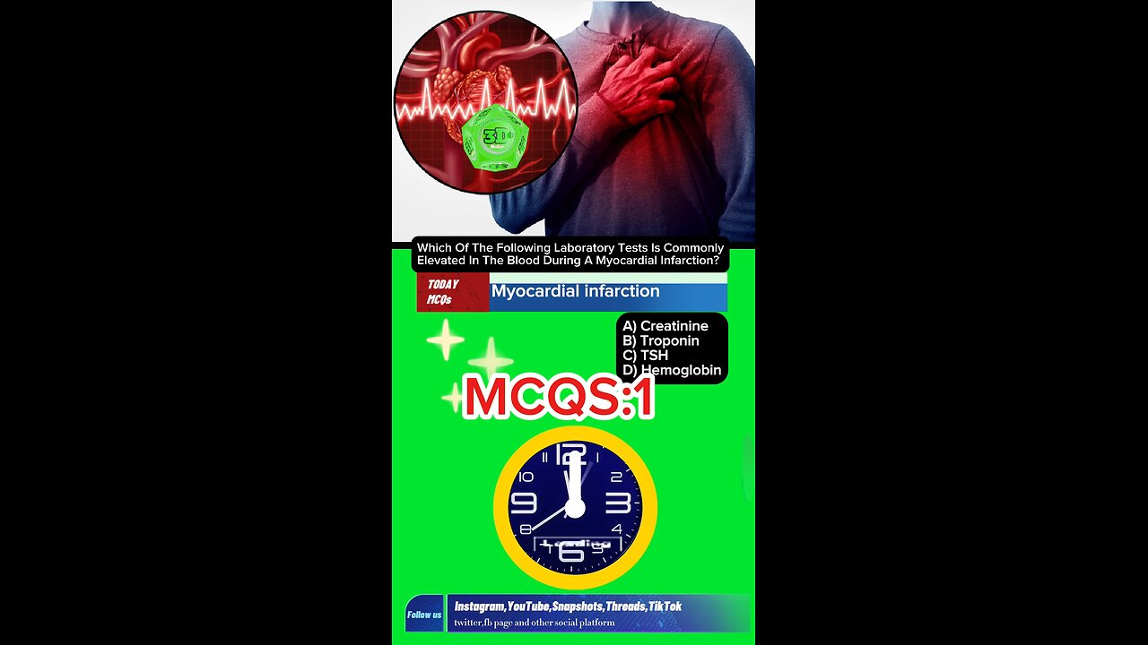 Myocardial infarction mcqs