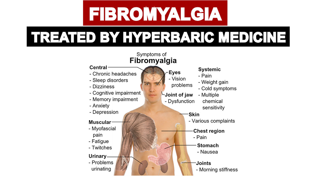 Fibromyalgia Treated by Hyperbaric Medicine