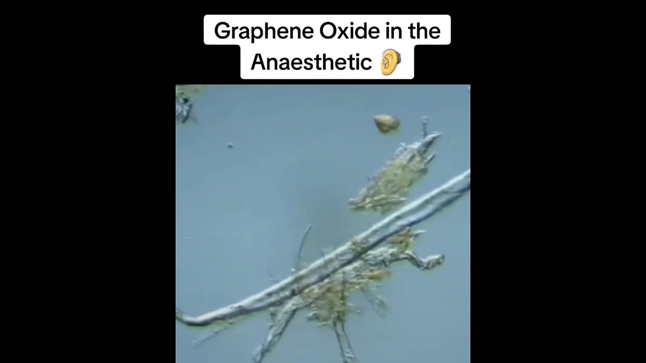 GRAPHENE OXIDE in the ANAESTHETIC #FUCKtheJAB