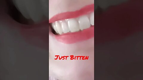Bright Whites in 3 Seconds!