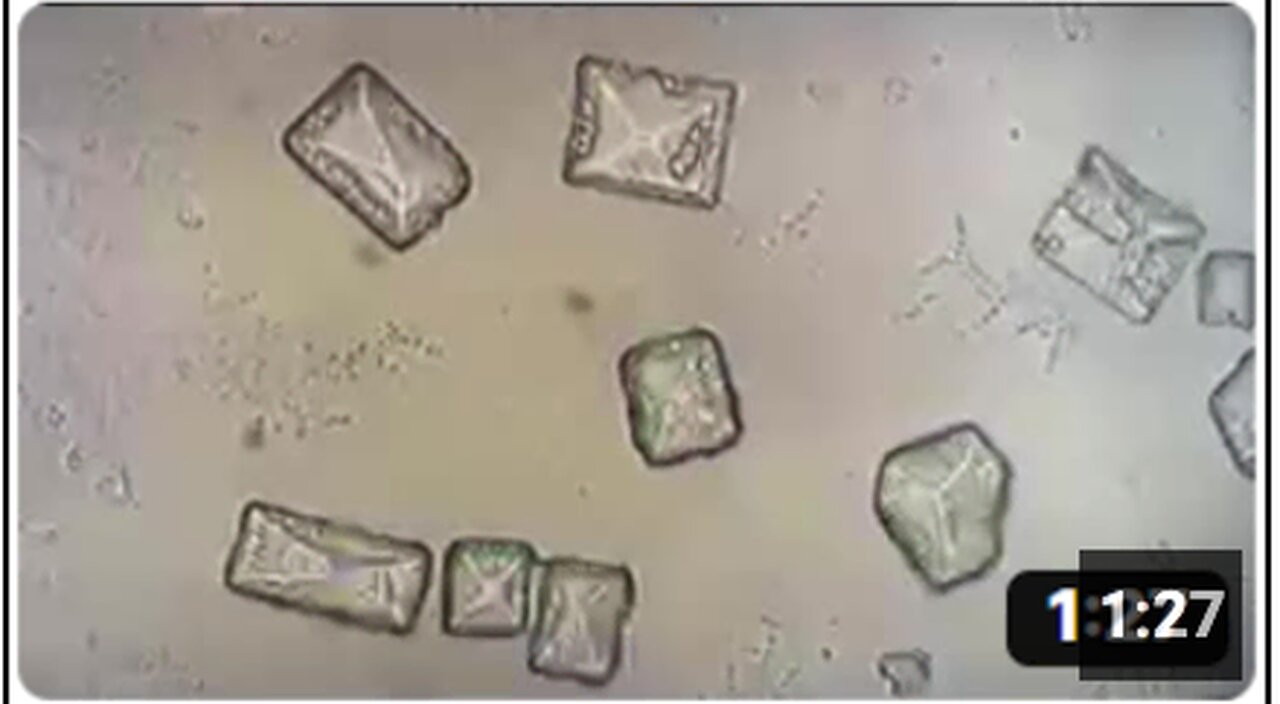 Biochips Viewed in the Unchanged Live Blood Under pHase Contrast, Darkfield & Brightfield Microscopy