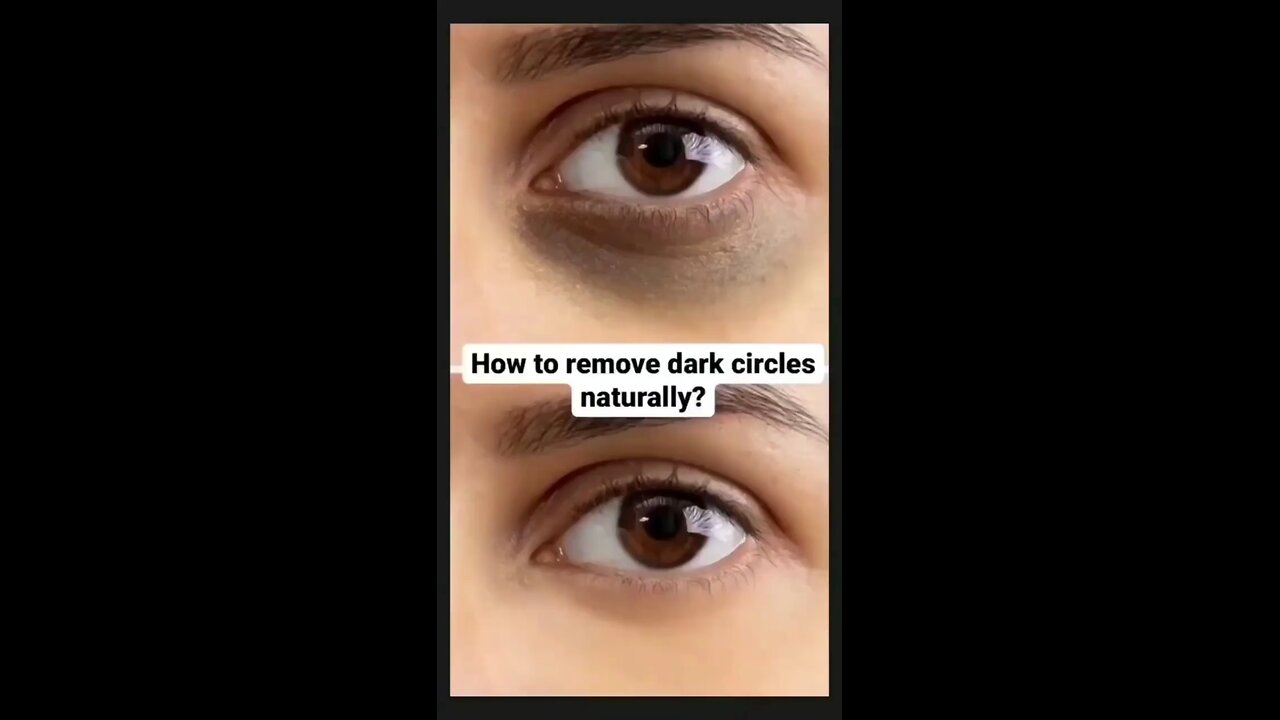 How to remove dark circle- at home || DIY || skin care || eye care