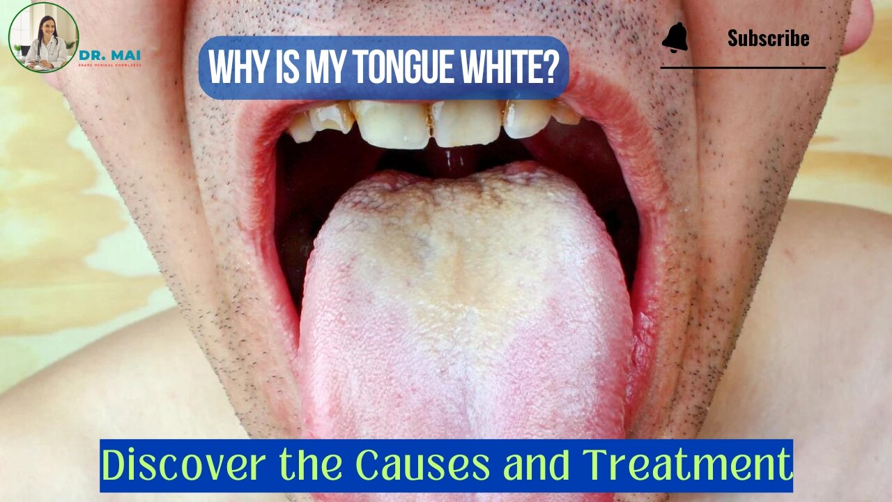 What is A White Tongue A Symptom of? | DR. MAI