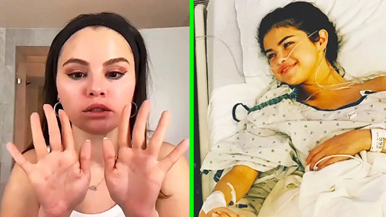 Fans concerned about Selena Gomez's health