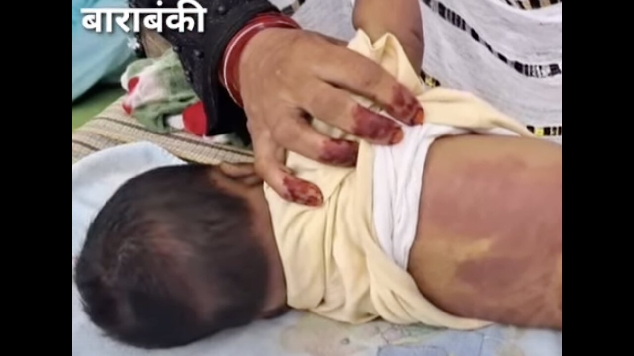 Uttar Pradesh: 3 month old baby died following vaccination