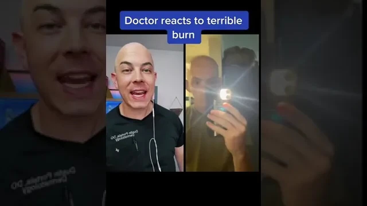 Doctor reacts to horrible sun burn! #bald #sunburn #dermreacts #doctorreacts #wearsunscreen