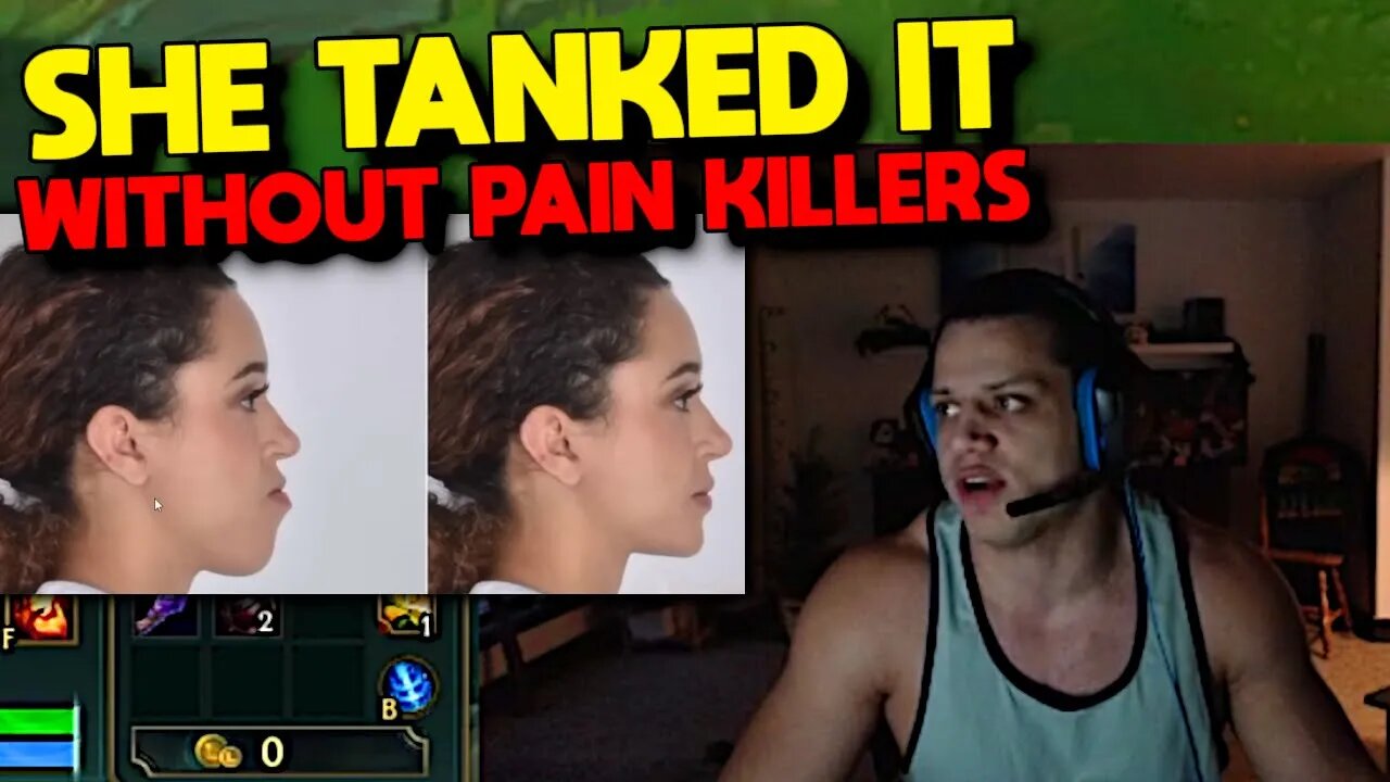 Tyler1 on Macaiyla's PAINFULL Surgery