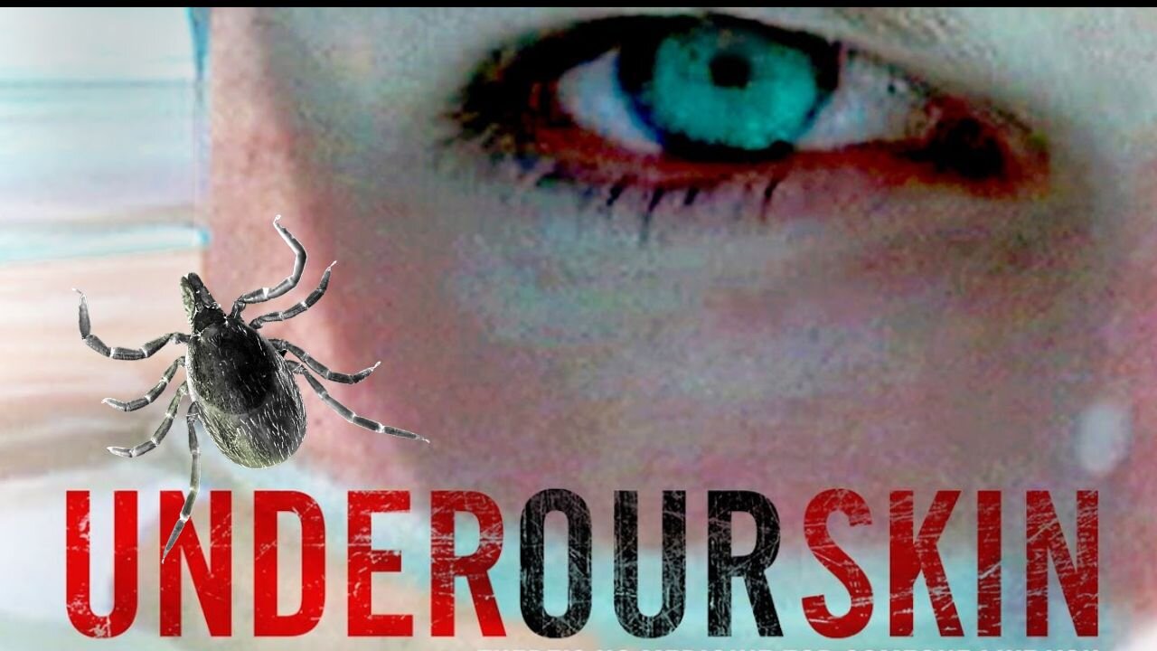 Under Our Skin - Exposing the Hidden Epidemic of Lyme Disease - Award Winning Documentary