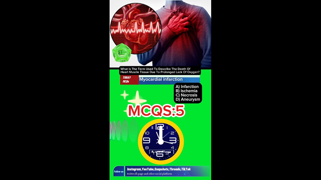 Myocardial infarction mcqs