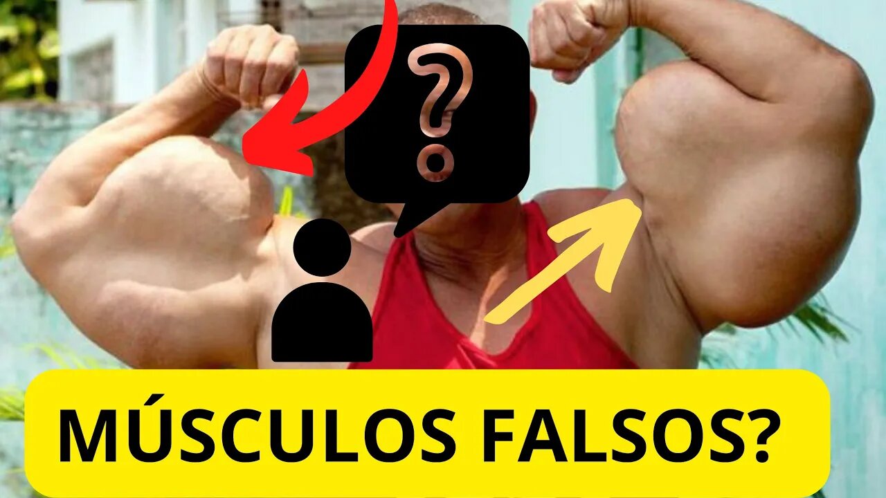 Pessoas com MÚSCULOS Falsos [Arlindo Anomalia]