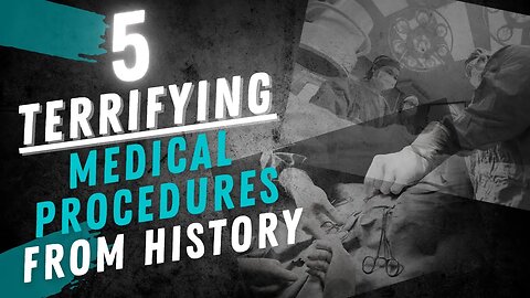 5 Terrifying Medical Procedures from History