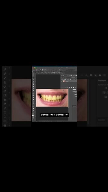 Adobe Photoshop Tutorial Perspective ( Whiten Teeth in Photoshop)#shorts