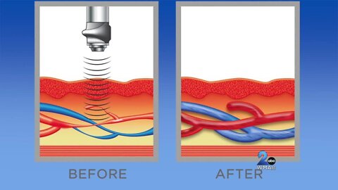 Maple Grove Medical Clinic - February 7, 2023